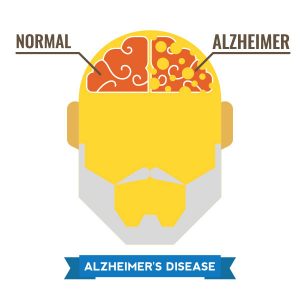 Four Different Types Of Dementia: The Causes, Symptoms, And Treatments