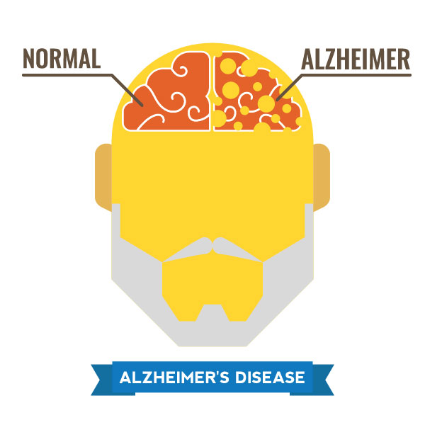 Four Different Types of Dementia: The Causes, Symptoms, and Treatments